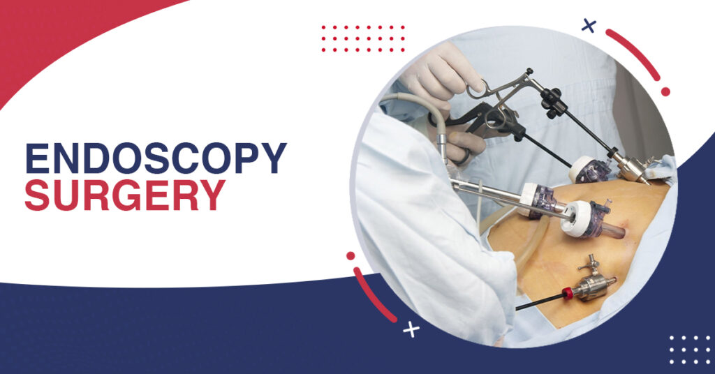 Endoscopy Surgery