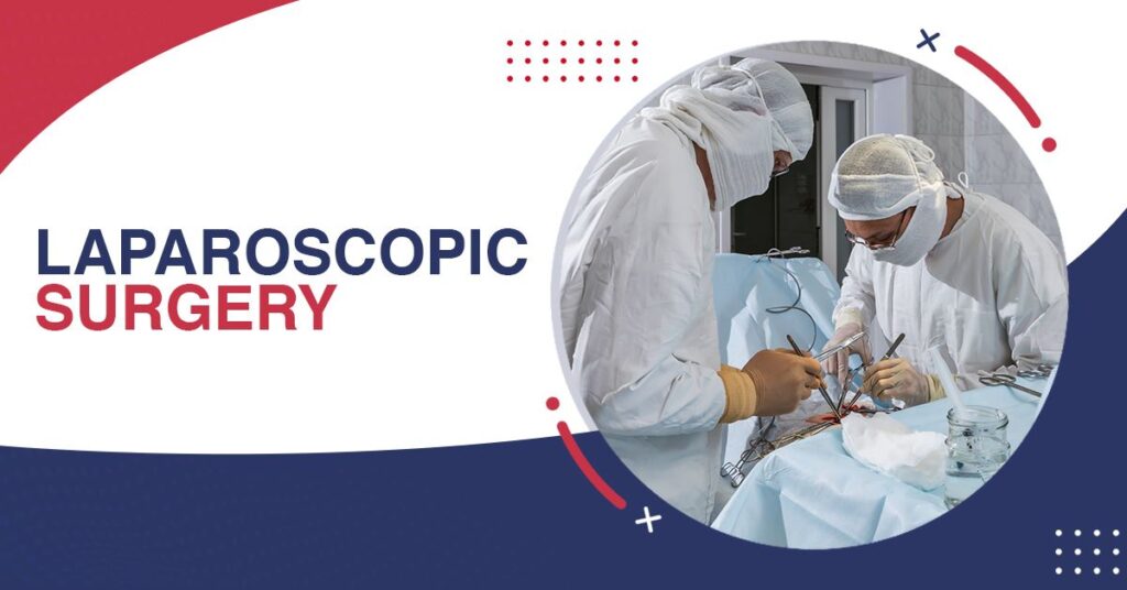Laparoscopic Surgery